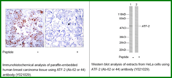 Anti-ATF2 (Ab-62/44)