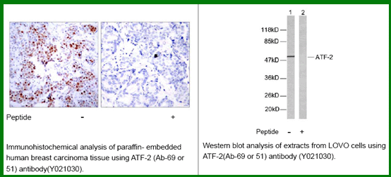 Anti-ATF2 (Ab-69/51)
