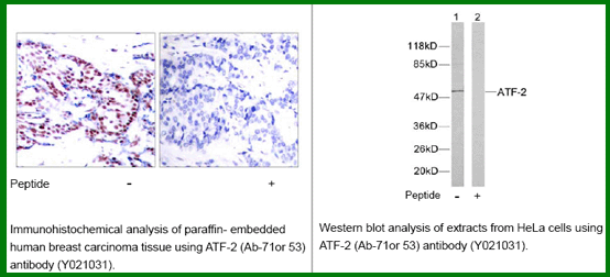 Anti-ATF2 (Ab-71/53)