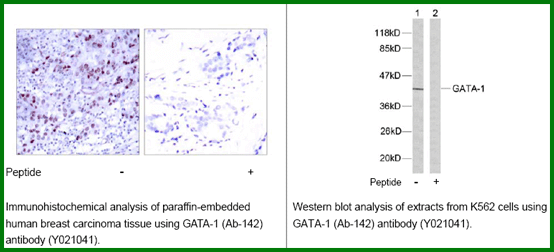 Anti-GATA1 (Ab-142)