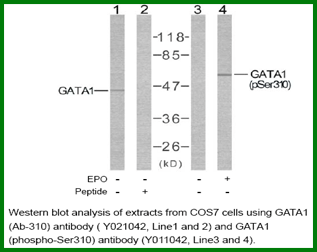 Anti-GATA1 (Ab-310)