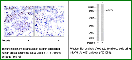 Anti-STAT6 (Ab-645)