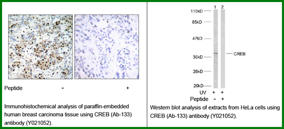 Anti-CREB (Ab-133)