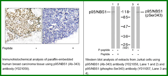 Anti-p95/NBS1 (Ab-343)