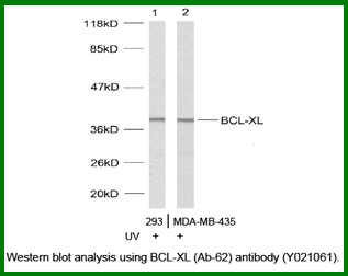 Anti-BCL-XL (Ab-62)