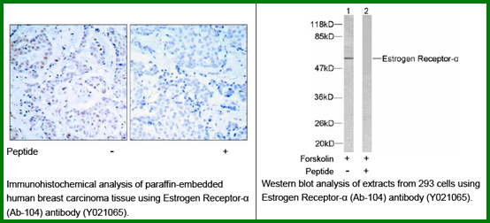 Anti-Estrogen Receptor-&alpha; (Ab-104)