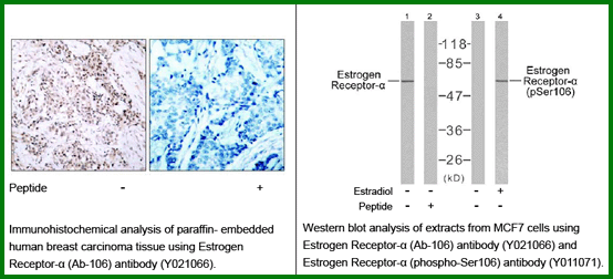 Anti-Estrogen Receptor-&alpha; (Ab-106)