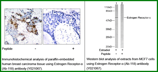 Anti-Estrogen Receptor-&szlig; (Ab-118)