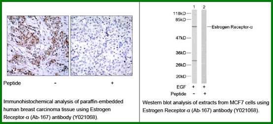 Anti-Estrogen Receptor-&alpha; (Ab-167)