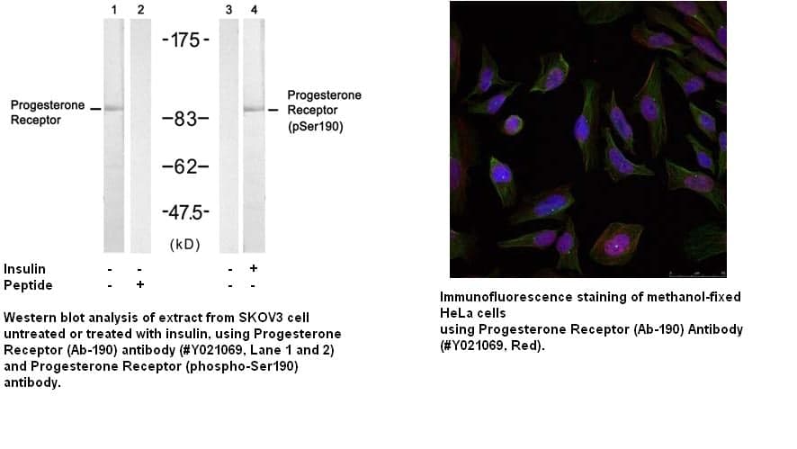 Anti-Progesterone Receptor (Ab-190)