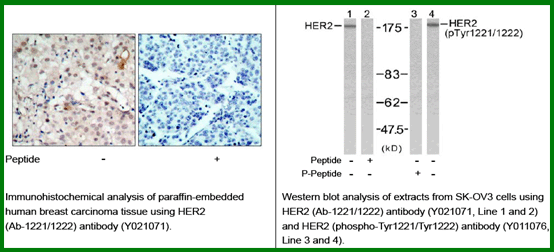Anti-HER2 (Ab-1221/1222)