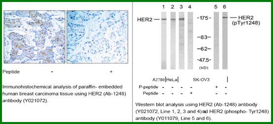 Anti-HER2 (Ab-1248)