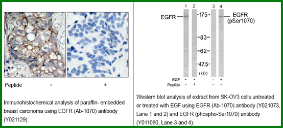 Anti-EGFR (Ab-1070)