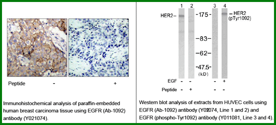 Anti-EGFR (Ab-1092)