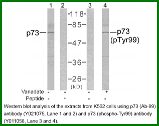 Anti-p73 (Ab-99)