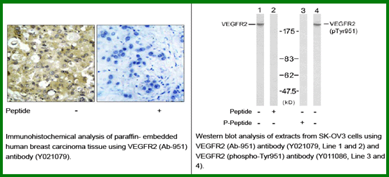 Anti-VEGFR2 (Ab-951)
