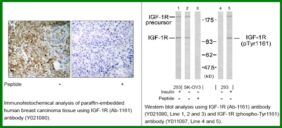 Anti-IGF-1R (Ab-1161)