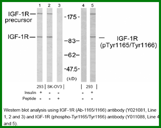 Anti-IGF-1R (Ab-1165/1166)