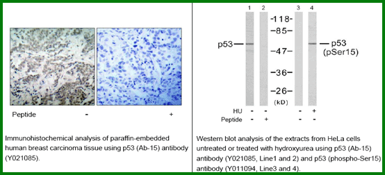 Anti-p53 (Ab-15)