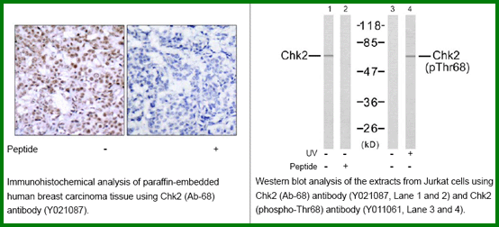 Anti-Chk2 (Ab-68)