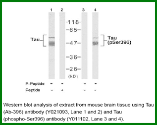 Anti-Tau (Ab-396)