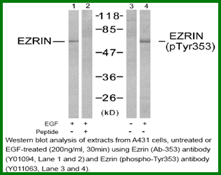 Anti-Ezrin (Ab-353)