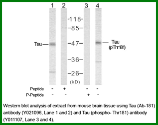Anti-Tau (Ab-181)