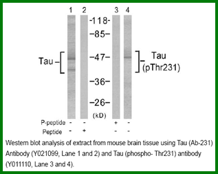Anti-Tau (Ab-231)