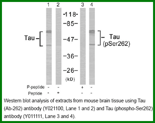 Anti-Tau (Ab-262)
