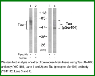 Anti-Tau (Ab-404)