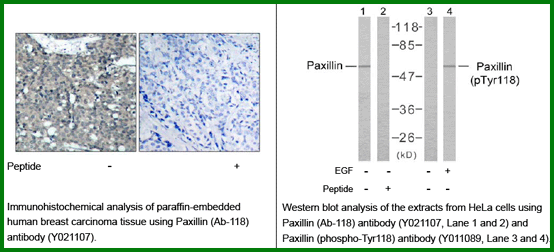 Anti-Paxillin (Ab-118)