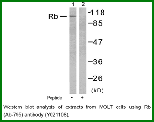 Anti-Rb (Ab-795)