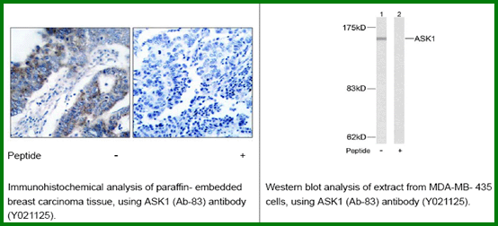 Anti-ASK1(Ab-83)
