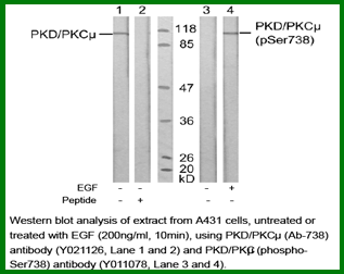 Anti-PKD/PKC&mu; (Ab-738)