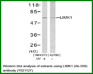 Anti-LIMK1 (Ab-508)