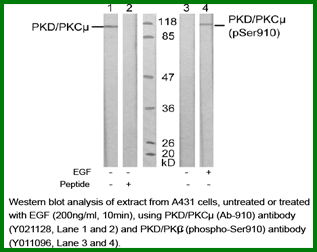 Anti-PKD/PKC&micro; (Ab-910)