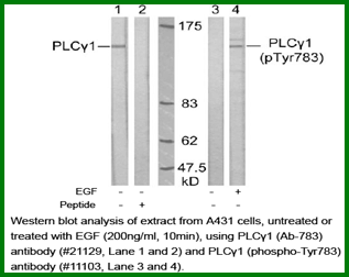 Anti-PLC&gamma;1(Ab-783)