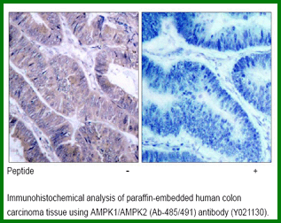Anti-AMPK1/AMPK2 (Ab-485/491)