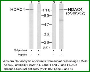Anti-HDAC4 (Ab-632)