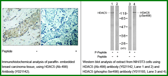 Anti-HDAC5 (Ab-498)
