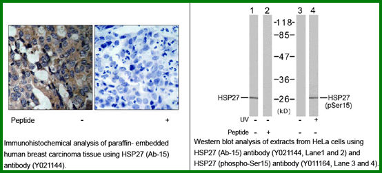 Anti-HSP27 (Ab-15)