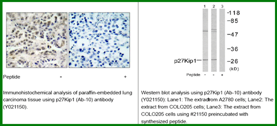 Anti-p27Kip1 (Ab-10)