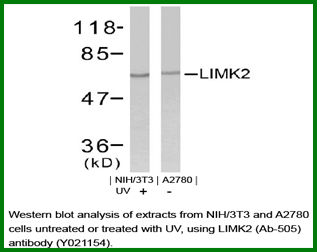 Anti-LIMK2 (Ab-505)
