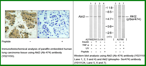 Anti-Akt2 (Ab-474)