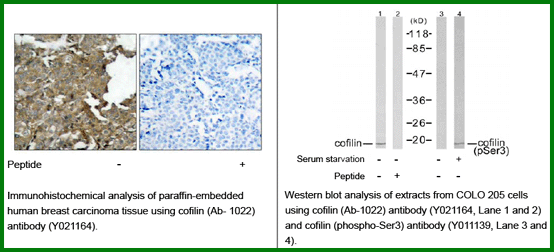 Anti-Cofilin (Ab-3)