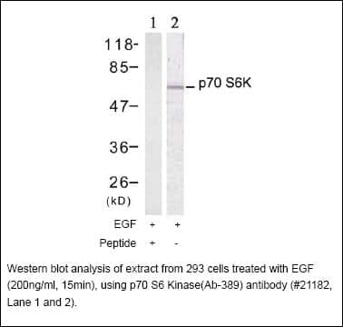 Anti-p70 S6 Kinase (Ab-389)