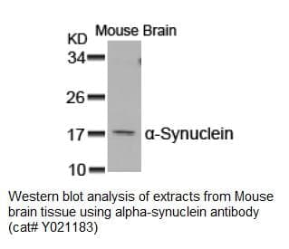 Anti-&szlig;-Synuclein (Ab-129)