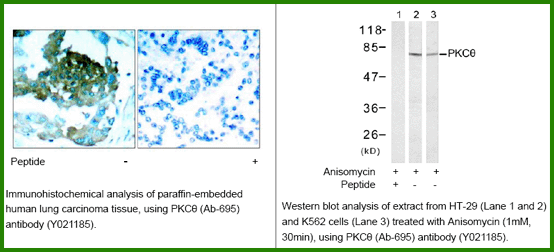 Anti-PKC&theta; (Ab-695)
