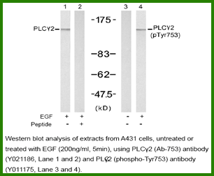 Anti-PLC&gamma;2 (Ab-753)