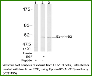 Anti-Ephrin-B2 (Ab-316)